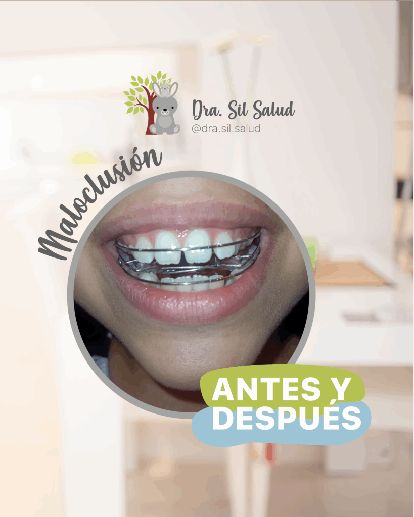 Sil 3